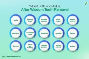 best soft foods to eat after wisdom teeth removal