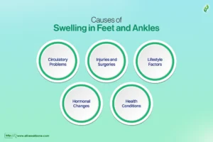 Causes of Swelling in Feet and Ankles