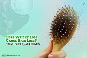 Does Weight Loss Cause Hair Loss Timing, Causes, and Recovery